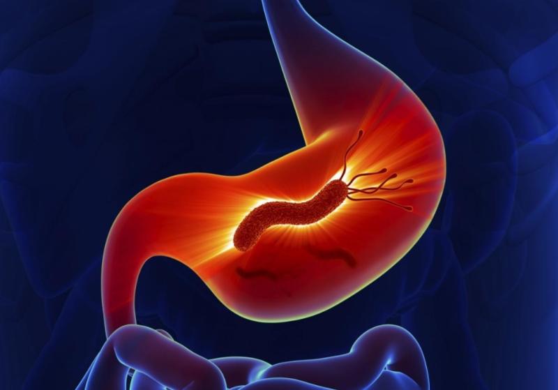 Хеликобактер пилори: как выявить и вылечить